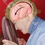 Motor vehicle accidents can cause brain injury