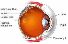 u of m retina detachment surgery